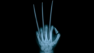 Wolverine X Ray 2K Wallpaper